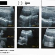 犬の膀胱がん（移行上皮癌）にコルディを投与し腫瘍が縮小した症例